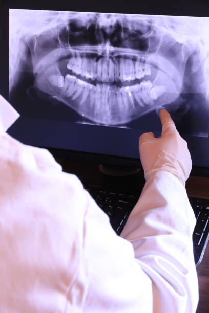 Best Weekend Emergency Dentist in Otterbe, IN