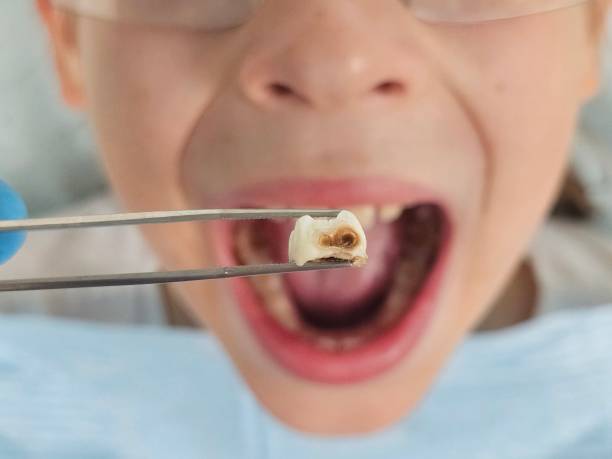 Best Emergency Dental Care for Trauma or Injury in Otterbe, IN